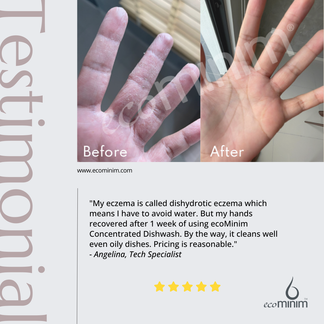 Testimonial-Angelina